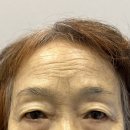 대건메디칼 | [리얼후기] 내 눈썹같은 자연스러움 강남눈썹반영구 ‘투엠 메이크업’