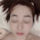 [일산신부관리 일산여드름관리 장항동피부관리] 인아벨에스테틱에서 얼굴수기관리 제대로 받았어요.
