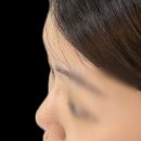 동의생한의원 | 코프팅 3개월 후기 + 병원 선택법