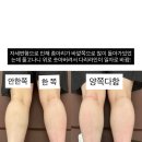 엔피티 | 1회만으로도 다리가 가벼워졌어요, 이게 10번이면 몸이 완전히 달라집니다