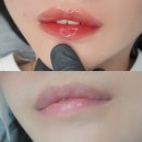 아트인디고 | 마곡입술 아트인디고 얇고 각징 많은 짝짝이입술 탈출 후기