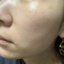 순한화장품 이수연코스메틱 실사용 중, 후기 (1일, 5일, 10일 13일 차)