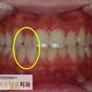 연세미소담은치과 이미지