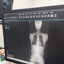 노원삼성정형외과의원 네이버블로그