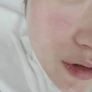 신데렐라 | 송도 피부관리 싸이블로 &amp; MTS 살롱드신데렐라 후기