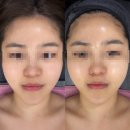 스킨메르피부연구소 | 케어 맛집! 수다 맛집! 김서이 피부연구소 케라손 스킨스케일링 후기