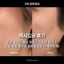 오소네일 | 구의 페이스 관리/왁싱 잘하는 곳 오소왁싱에서 엑시드닝 1:1 맞춤 케어 후기