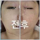 더셀 | 천안피부관리 잘하는 곳 불당동에스테틱 더셀에스테틱 솔직후기