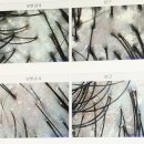 이브케어 인천지점 | 인천두피관리 모바이오 송도점 두피진단&amp; 퍼스널 케어 후기