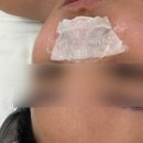 (주)마이티워터 | [충북혁신도시 피부관리] 고원장의 모공세척 테라피
