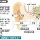 보청기가 사용하기 어려운 사람에 대응하는 새로운 장치…「지금까지 들리지 않았던 환풍기 소리를 듣게 되었다」 이미지