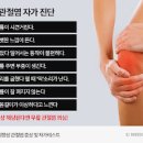 관절염 보스웰리아 먹으면 좋아지는 점 성분 안좋은 점 먹는방법 이미지