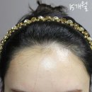 모델헤어라인 이미지