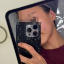 신정한의원 | 신정네거리 한의원, 목동 한의원 세연한의원 라디쥬 플러스 스킨부스터 후기! 하나도 안아픈 스킨부스터는?