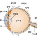 봄날, 안구건조증에 대해서 알아볼까요? 이미지