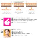 전주 울쎄라 써마지 미하이피부과 상담 후기