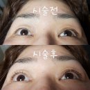 야시속눈썹&네일