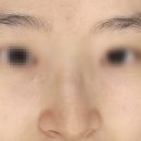 (주)한빛나노메디칼 | 대구 동촌유원지 동구피부관리 반영구전문점 홍화뷰티