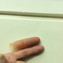 바른의수족제작연구소 이미지