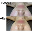 청화메디칼 | [부산명지에스테틱] 명지피부관리 꼼꼼하게 잘하는 곳 청화에스테틱