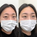 리메이드오산 | 송탄눈썹문신 선택한 후기 '리메이드 오산점'