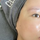 비본어뉴 | [대구동문동피부관리] 초민감 피부의 피부 스케일링 / 수분 케어 후기 <비본어뉴>