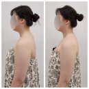 구리목 | 인창동 팔관리 전문가! 오늘, 동안 구리점에서 경험한 섬세한 케어 후기 💆‍♀️