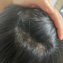 정수리 | 노비어 포뷰트 누아레모 두피타투 비교 남자 정수리 커버 후기