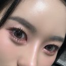 강남성형외과 애교필러 후기, 직접 경험한 솔직 리뷰