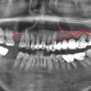 블랑쉬치과의원 이미지