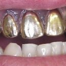 크라운사거리 이미지