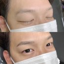 눈썹짱 이미지