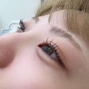 아이섭 이미지
