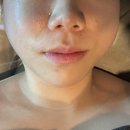 춘천순환로 | 춘천에스테틱 제이스킨앤바디 | 예민 피부 관리 솔직 후기