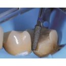 퍼즐치과기공소 이미지