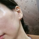 레파로 | 영등포 당산 피부관리 :: 마고스킨 찐으로 감동 후기 (여드름 문제성 피부 에스테틱 수분관리 홍조)