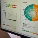 신논현역 | 신논현역 피부과 리쥬란 후기