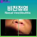 비전메디 네이버블로그