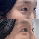 스킨모발팡팡 | 창원 중앙동속눈썹펌 모온뷰티 C컬 롯드 시술 후기, 유지 기간 2배 늘리는 홈케어 핵심 가이드