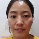 P-7723 | 모공케어 크림 추천 / 깐달걀크림 바데카실P