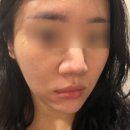 강남미코스메틱스 | 강남에스테틱 청담신부관리 뷰티블르바드 예비신부 수분물광관리 추천 후기