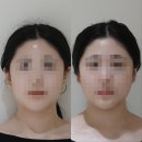 오직얼굴연구소 서초점 | 오직얼굴연구소 가격 서초점 관리권 이벤트