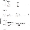 플루즈