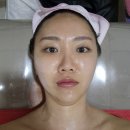 대구 윤곽관리 얼굴라인 정리 받고 온 후기 | 더채움뷰티샵