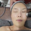 라라샵 | 대구 피부 관리 라라샵 초음파 페이스 리프팅 후기