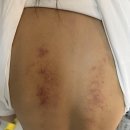 성북메디칼 | 성신여대 마사지 성북구 다이어트 피부관리 에스테틱 사운드바디 사운드스킨 성신 솔직후기