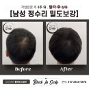 블랙인스칼프 이미지