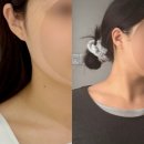 쓰리에이치광주봉선동센터 | 광주 봉선동 에스테틱 이엘에스테틱 써마웨이브 페이스/바디 1회 솔직 후기 (관리 전후 차이)
