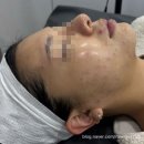 광명 철산 피부관리 잘하는 곳 ‘벨류어블 에스테틱’, 여드름피부 관리과정 공개