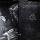 아름제일여성병원 이미지